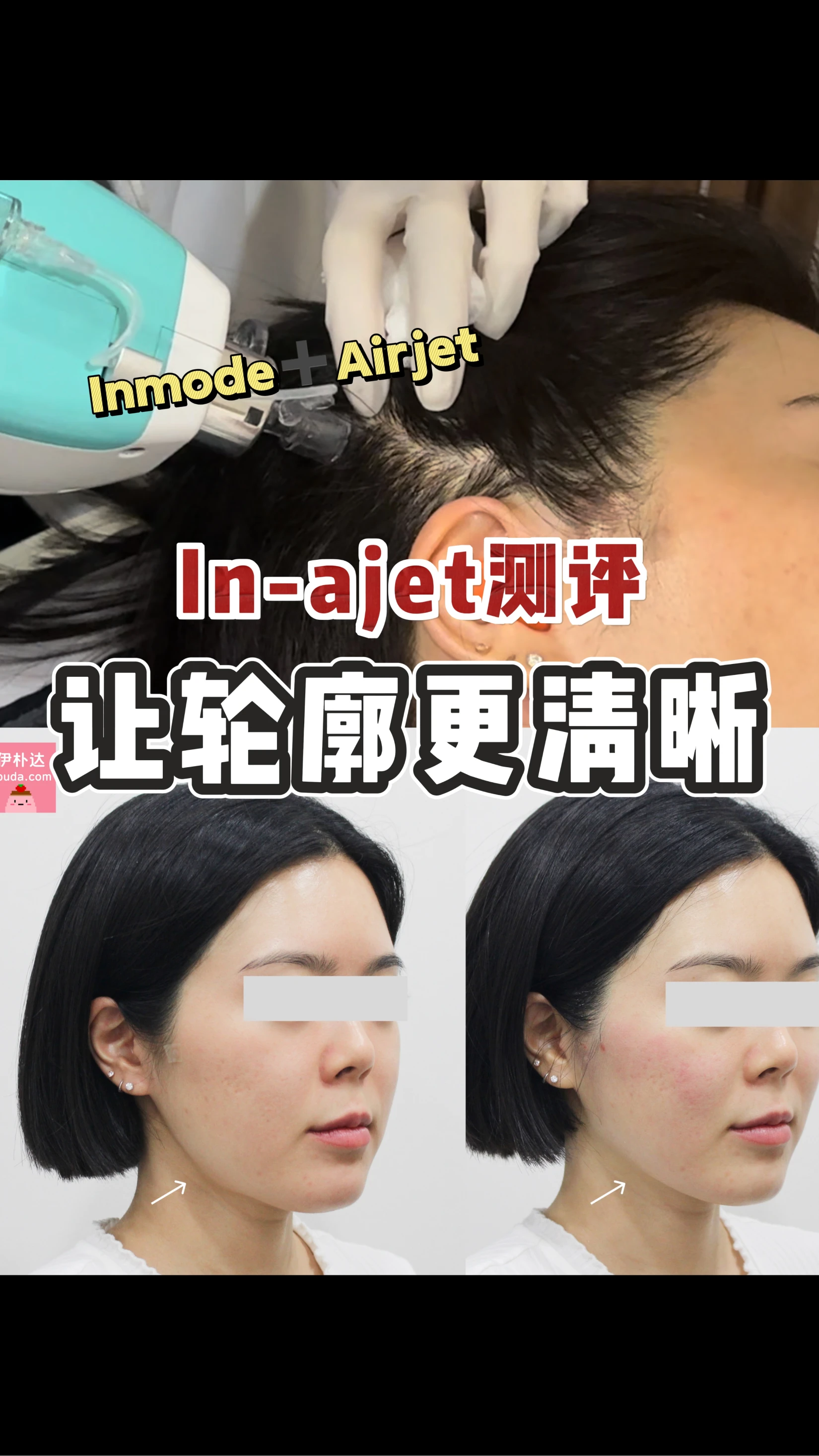 韩国独家提拉，脸变小一圈！💆‍♀️✨