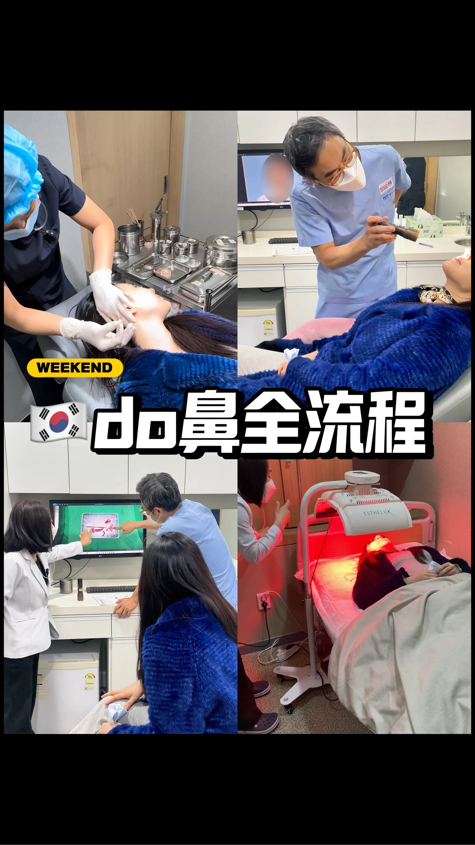 🇰🇷do鼻vlog|修鼻才是真技术