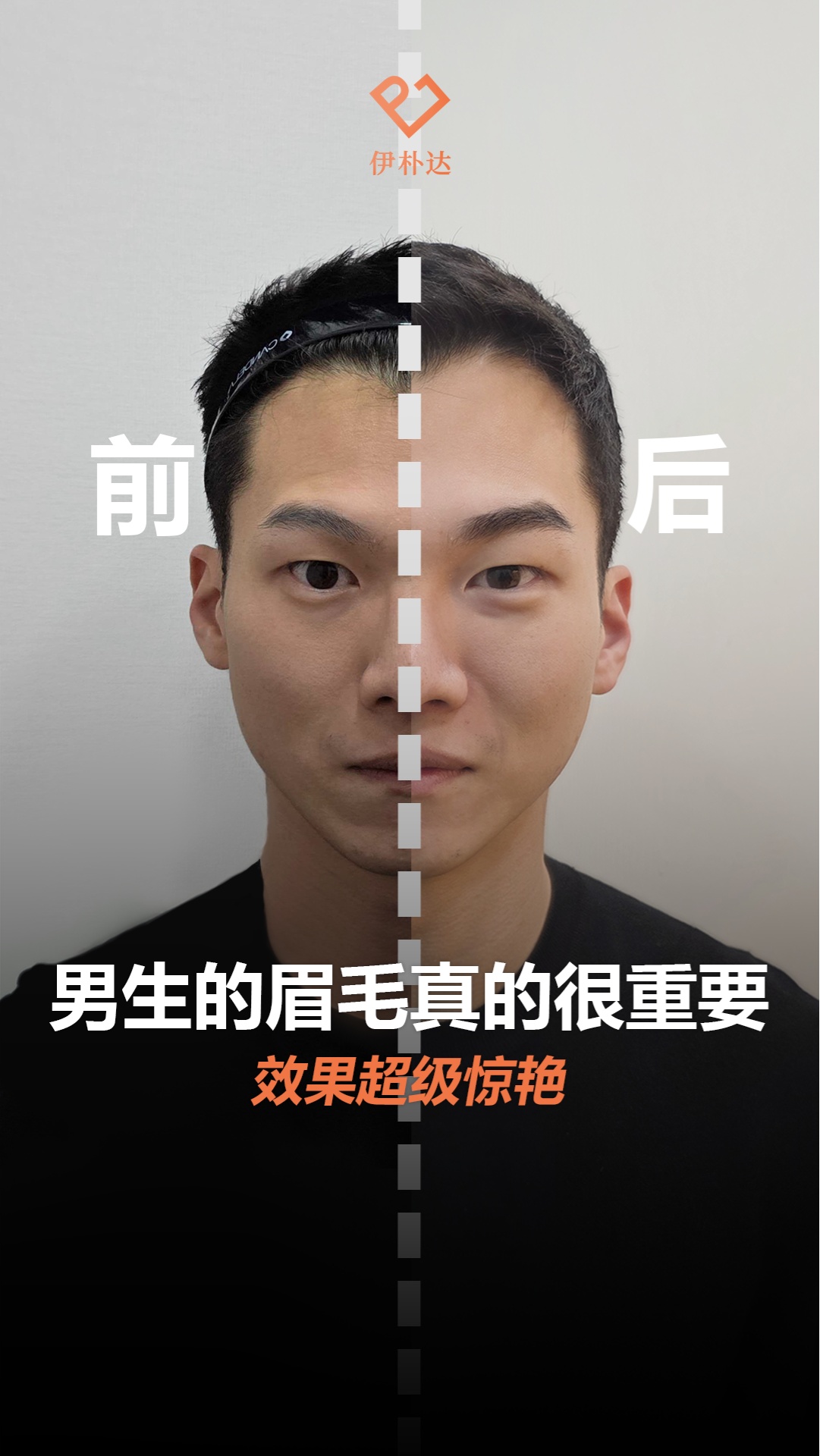 🙋🏻‍♂️男士颜值进阶的终极秘密武器